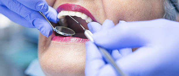 Best Knocked-Out Tooth (Avulsed Tooth) Treatment in Ridgway, CO